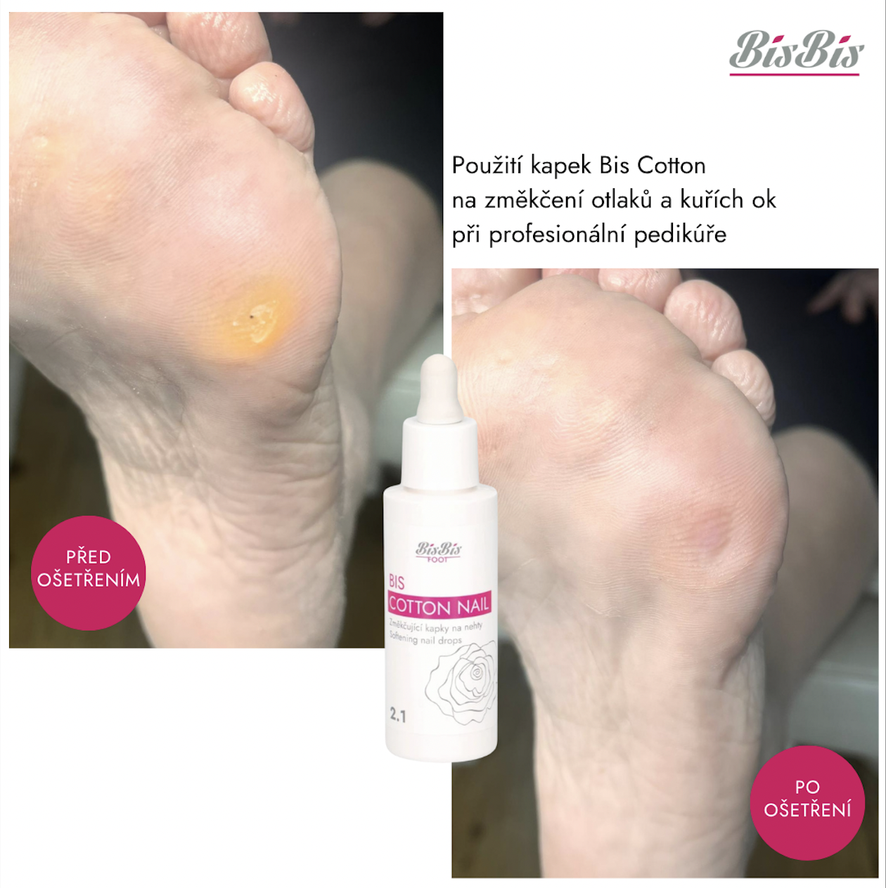 před po kuří oko cotton